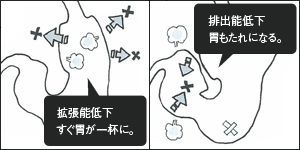 機能性胃腸症の原因